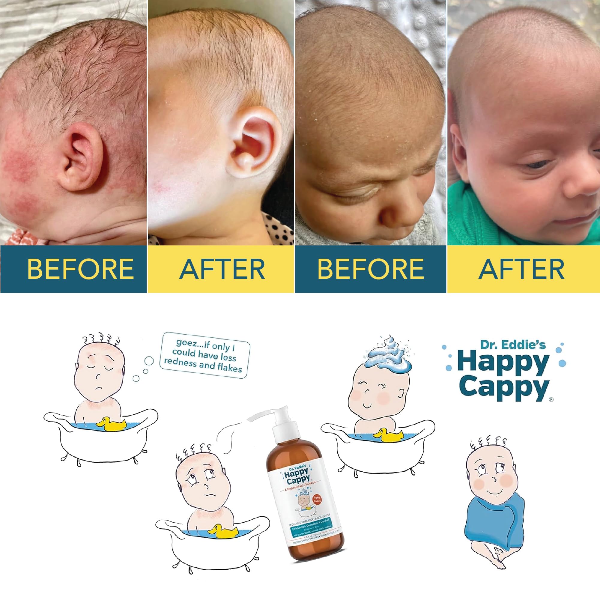 Happy Cappy Dr. Eddie’s medicated shampoo shows fragrance-free promise for sensitive scalps.