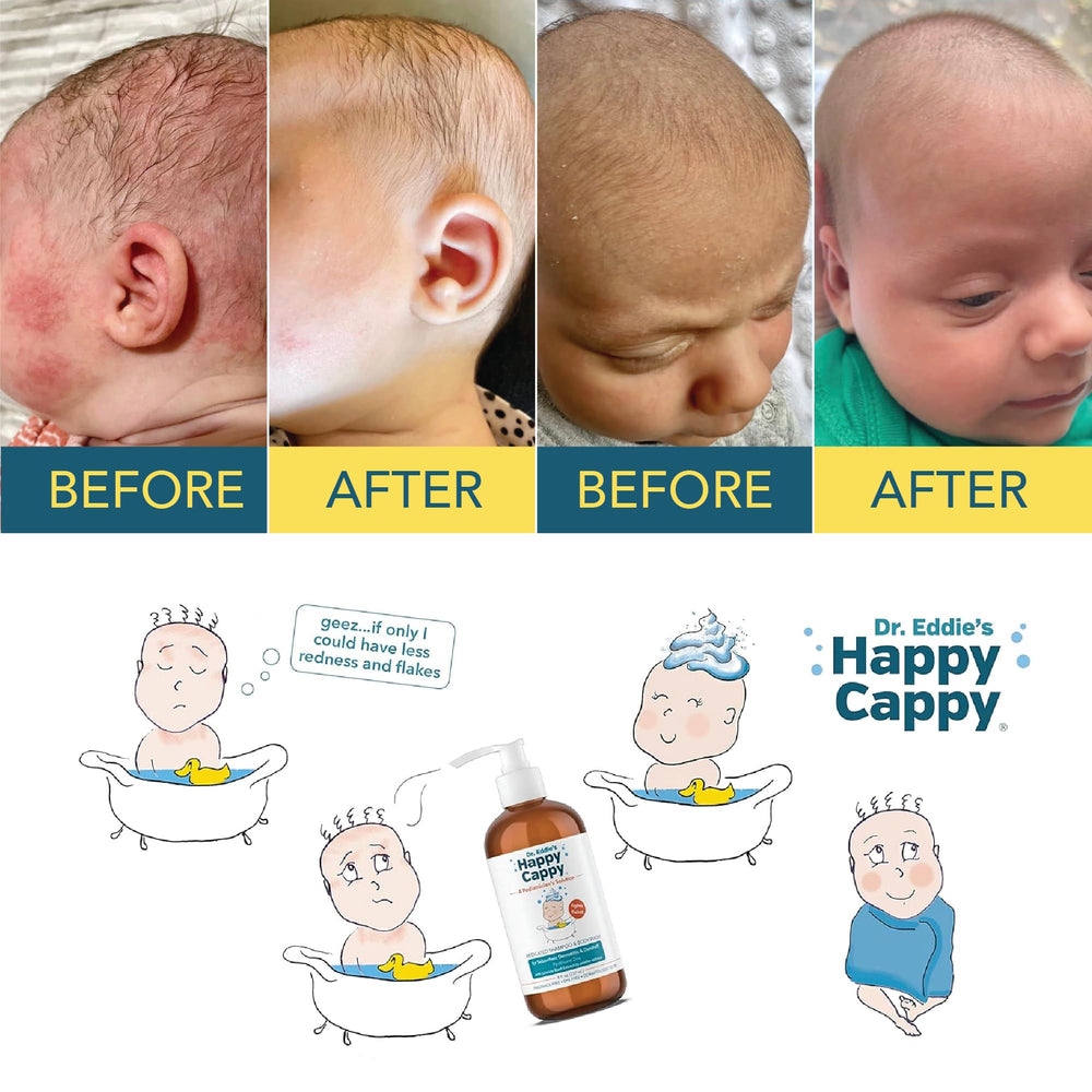 Happy Cappy Dr. Eddie’s medicated shampoo shows fragrance-free promise for sensitive scalps.