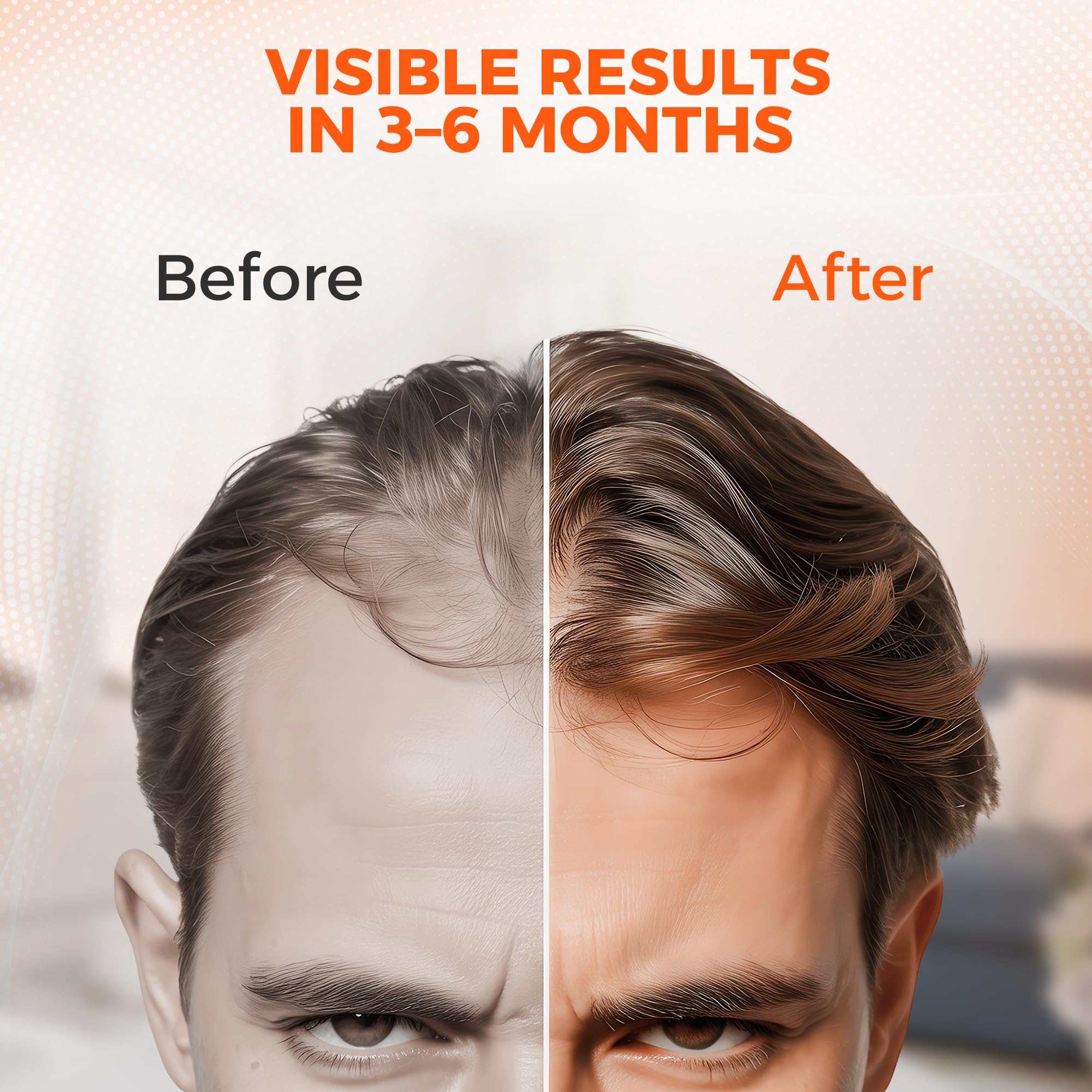 Happy Sol cap provides 60 mW/cm² irradiance for effective scalp reach.