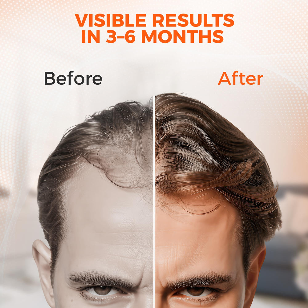 Happy Sol cap provides 60 mW/cm² irradiance for effective scalp reach.