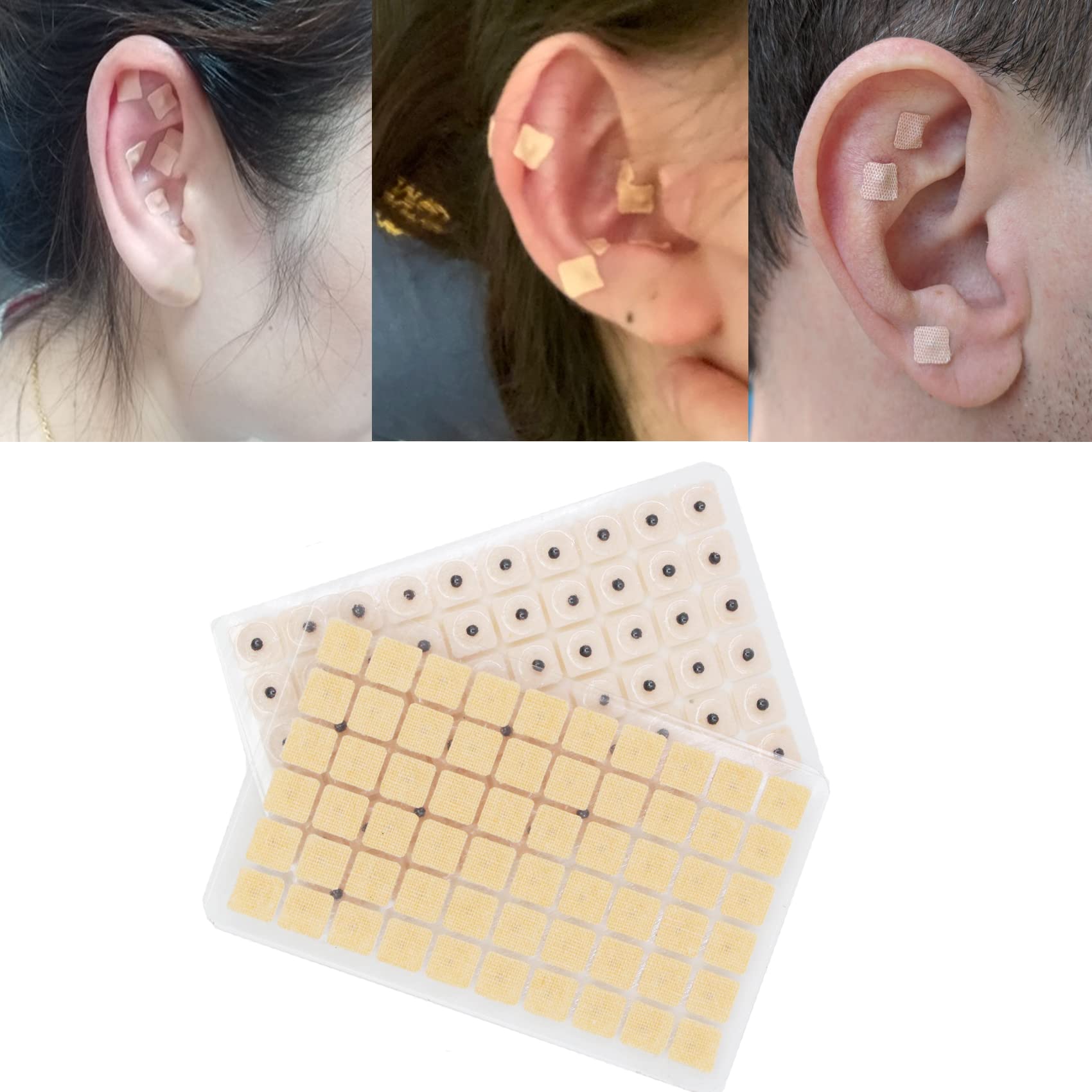 Hedigon auricular stickers close-up: high-quality ear seeds for precise placement.