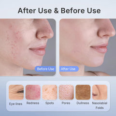 Hello Face LED chips at 630nm and 850nm target deeper layers for skin vitality.