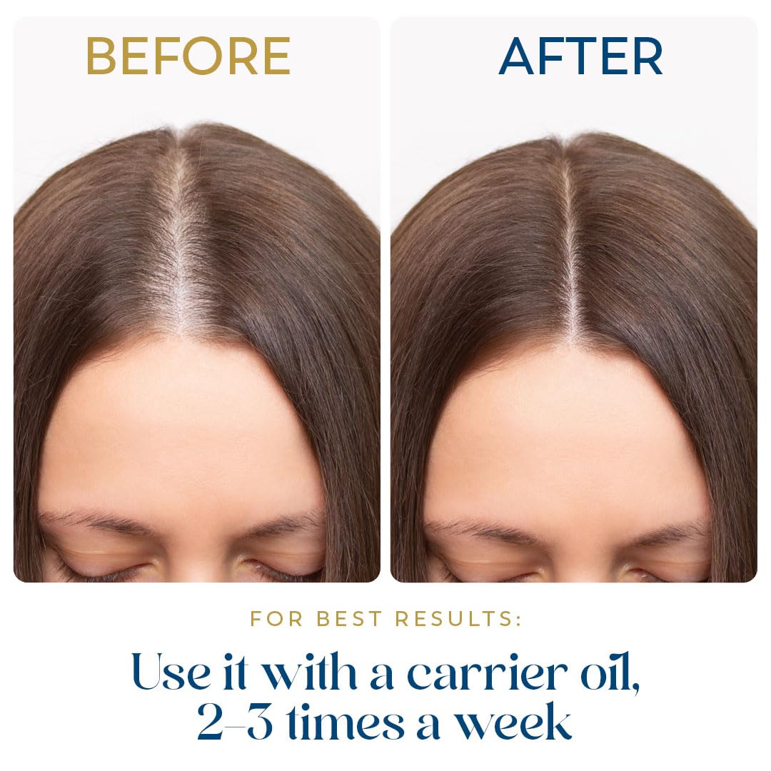 Herbsindia Rosemary Oil dropper delivering measured drops for styling.