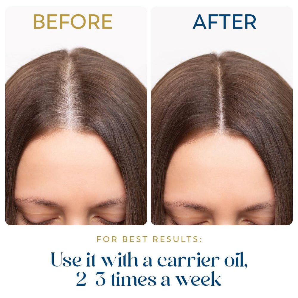 Herbsindia Rosemary Oil dropper delivering measured drops for styling.