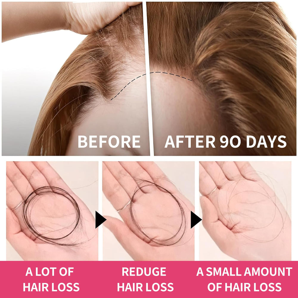 HiPlus pineapple flavor gummies provide a tasty habit for thinning hair goals