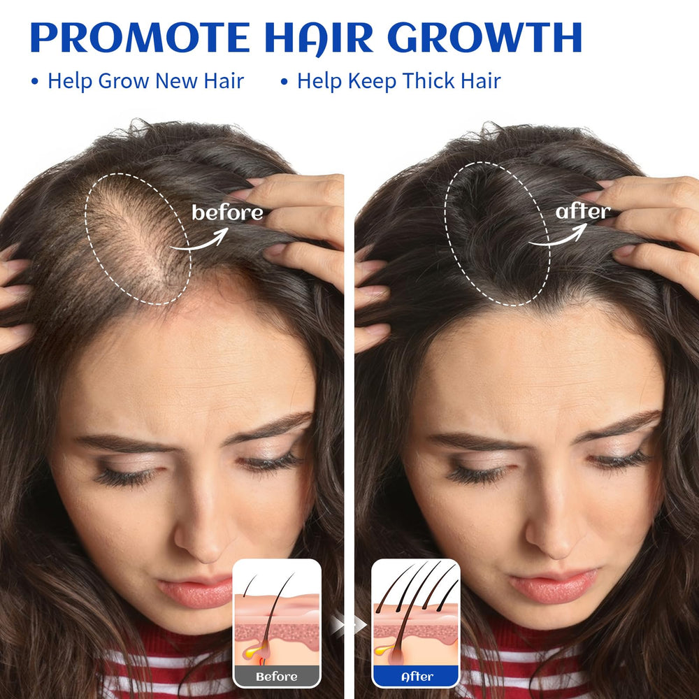 HIQILI Rosemary Oil dropper closeup—precise dosing for blends and scalp care.