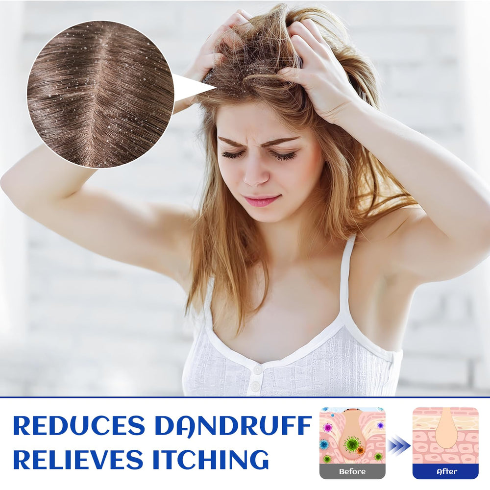 HIQILI Rosemary Oil in conditioner bottle—supports conditioning routine and scalp comfort.