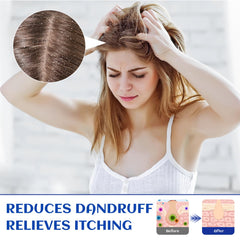 HIQILI Rosemary Oil in conditioner bottle—supports conditioning routine and scalp comfort.