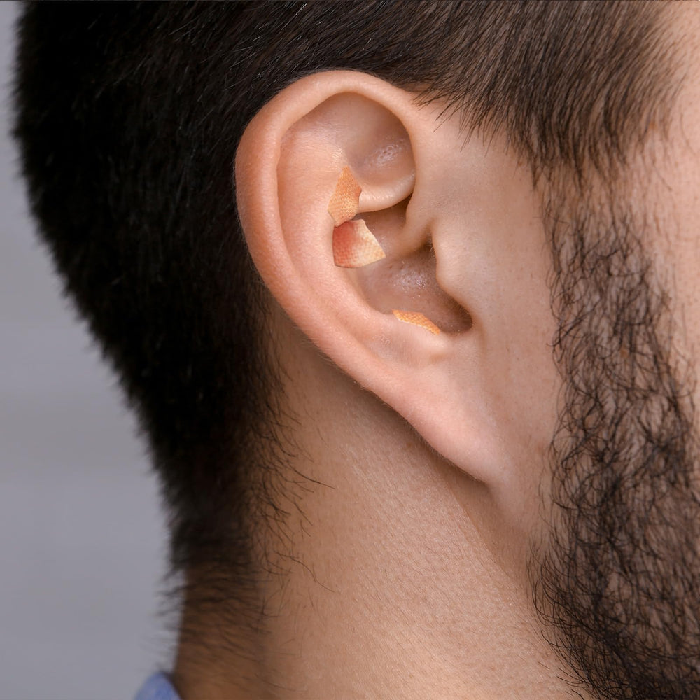 Honoson tweezers help precise patch placement on the ear