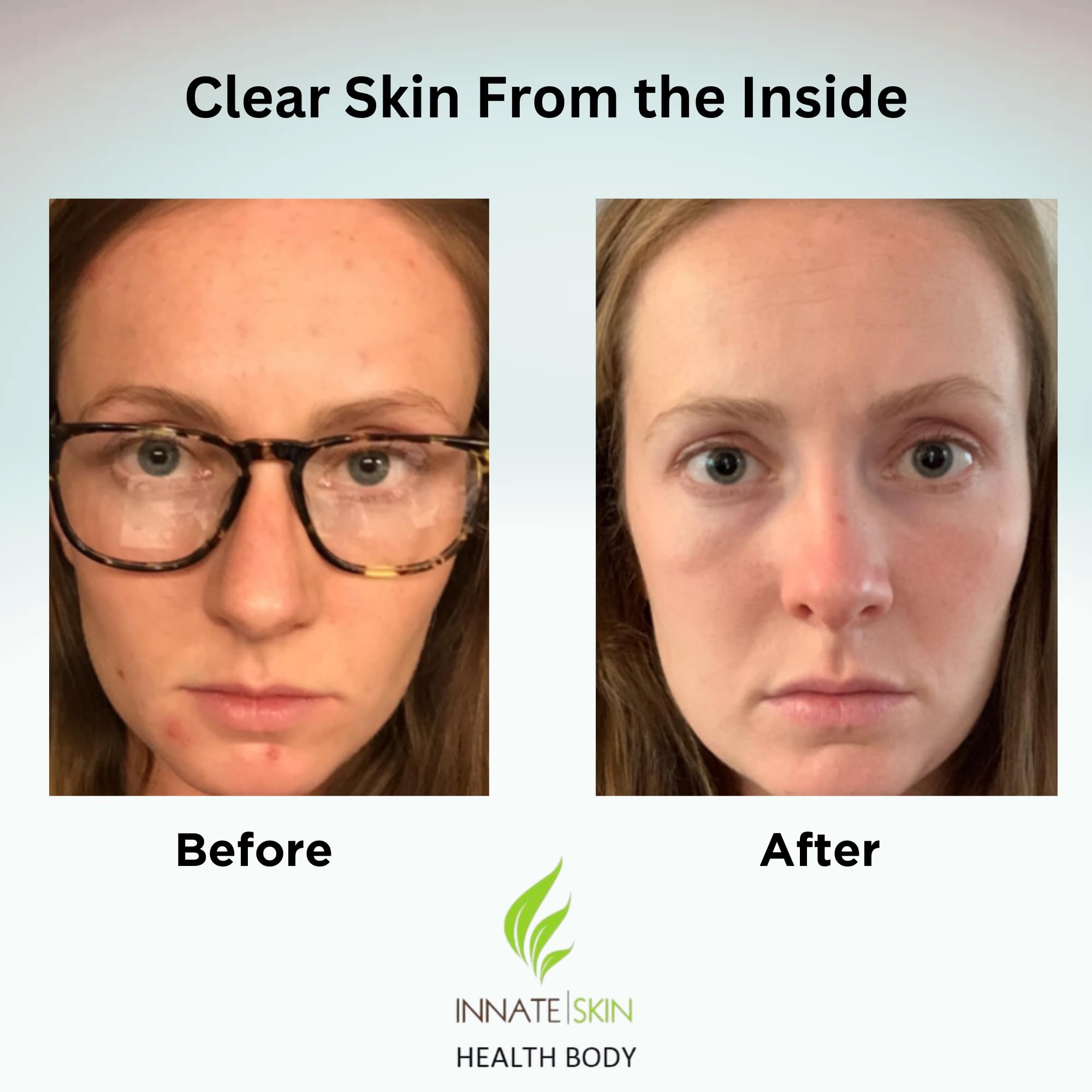 Innate Skin Clear Skin Vitamin System label showing key ingredients like turmeric