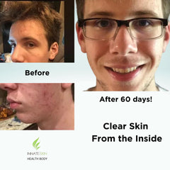Innate Skin Clear Skin Vitamin System packaging box on shelf