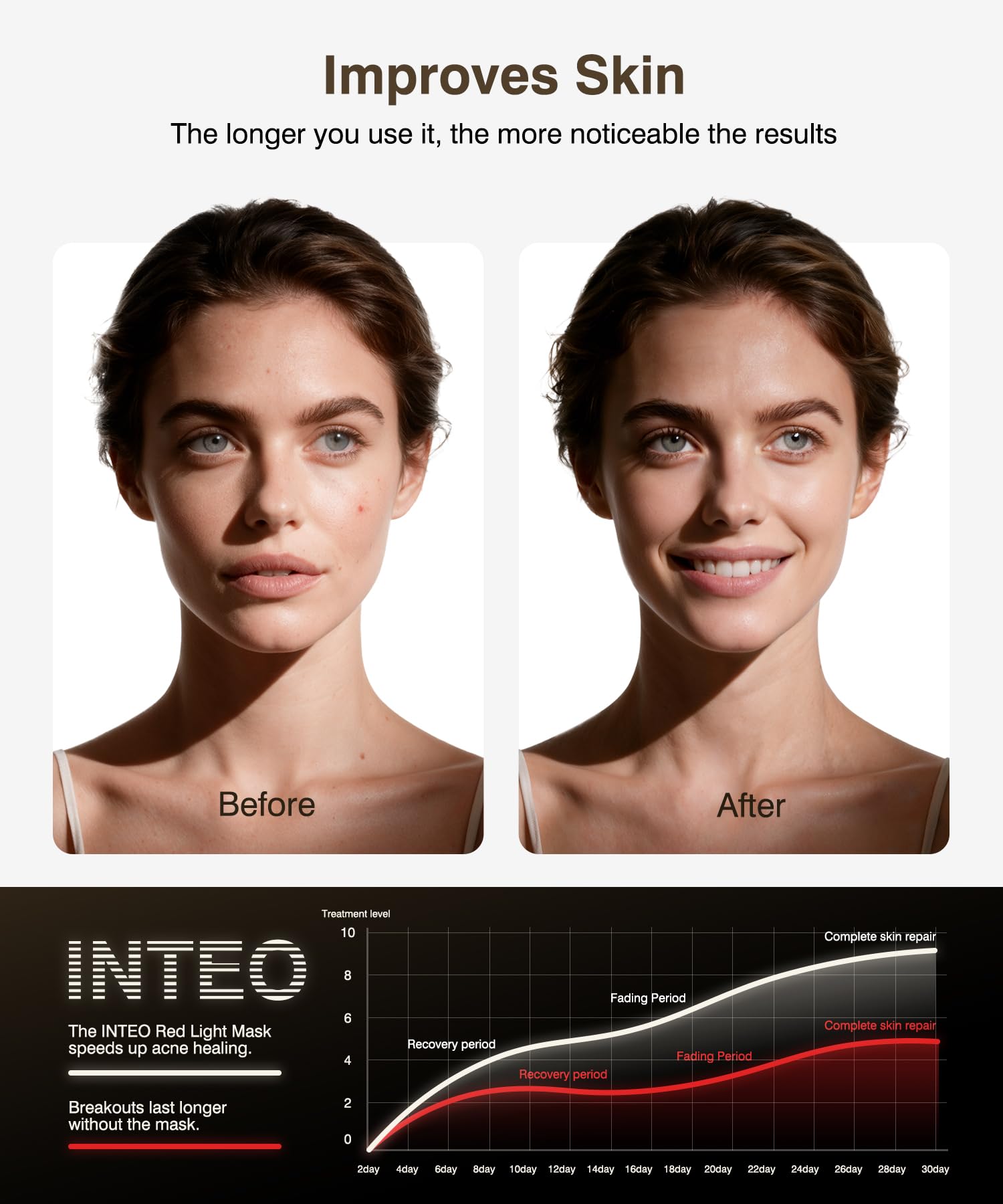 INTEO 680-bead close-up highlights dense bead arrangement