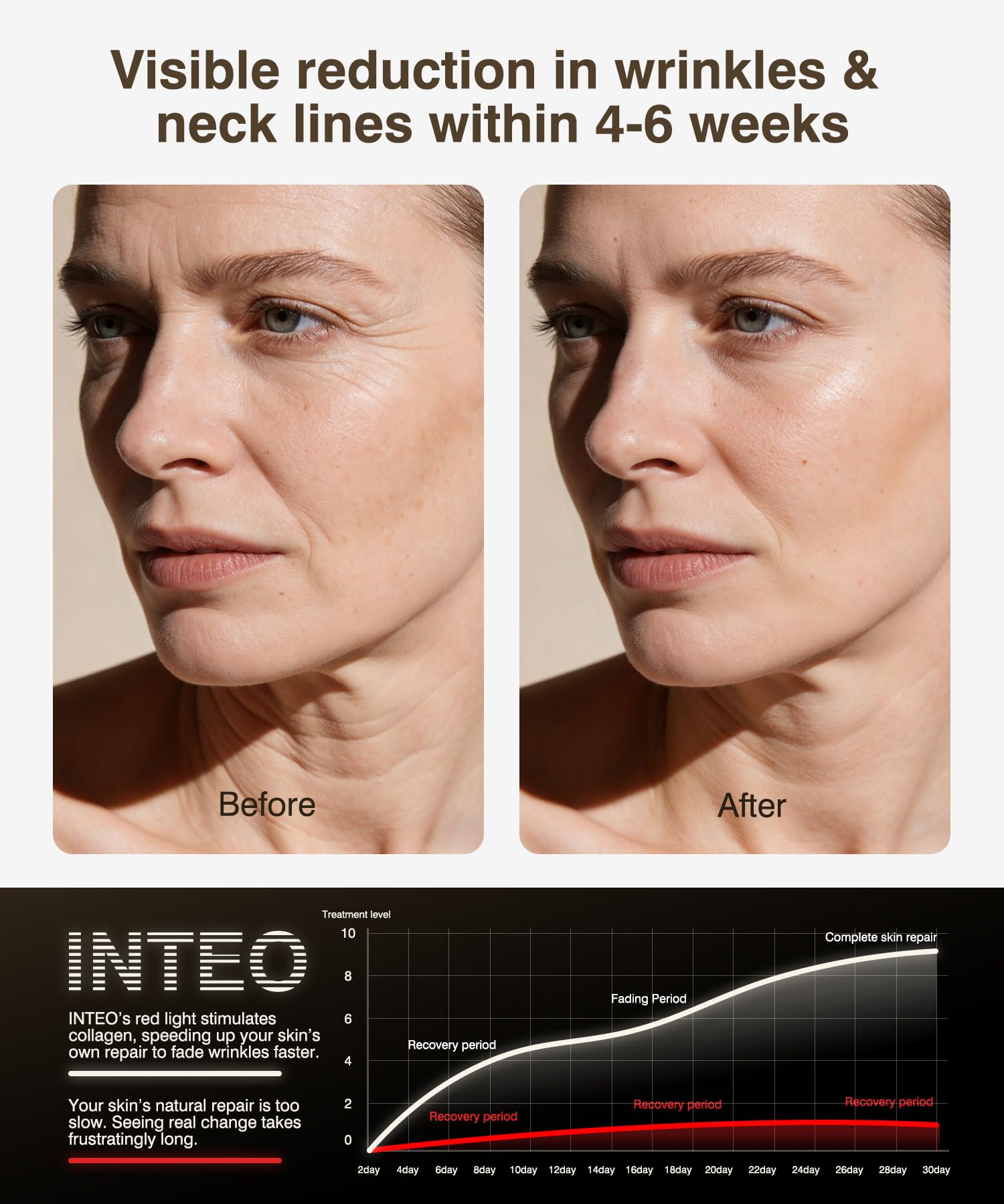 INTEO four-modes LED setup with infrared, red, orange and blue wavelengths