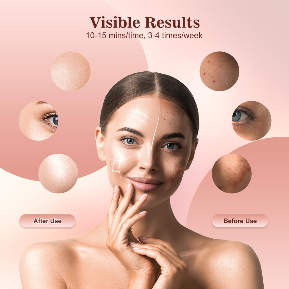 INTEO red light mask blue and yellow modes for oil balance and redness relief.