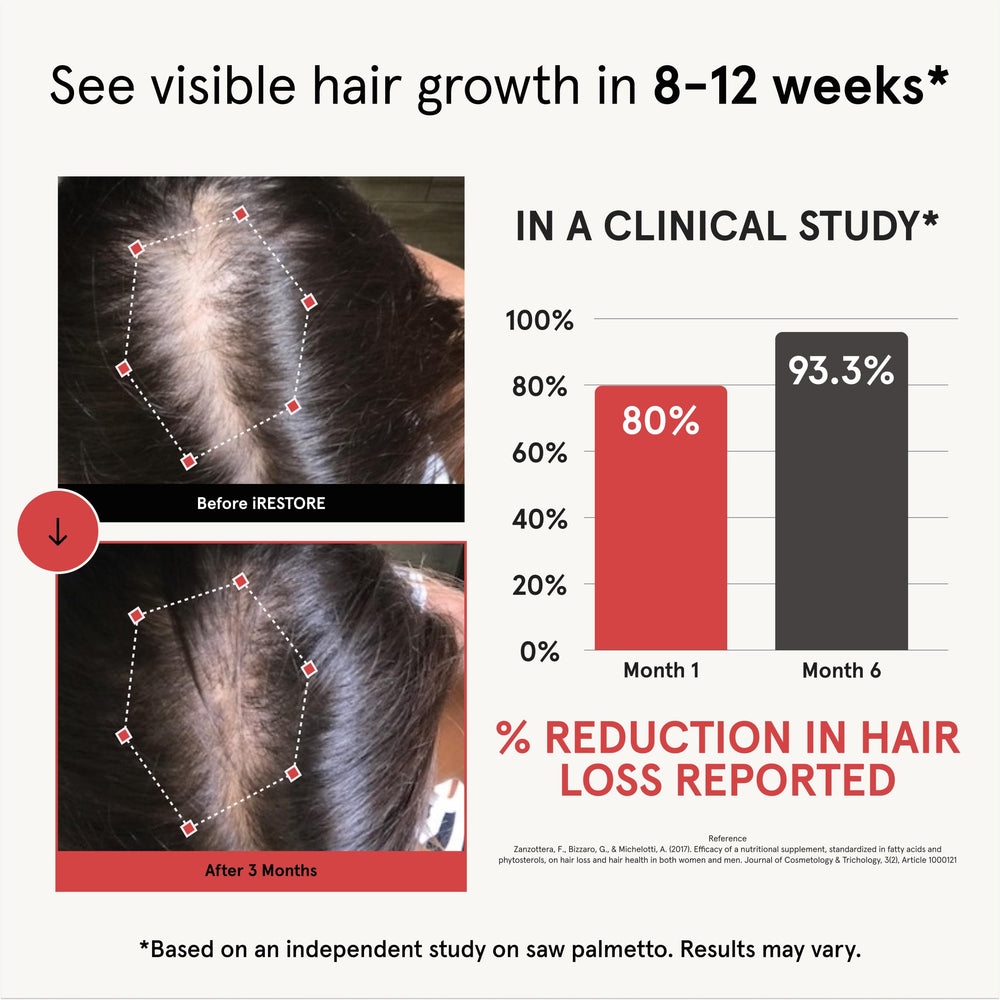 iRestore capsules closeup highlights vegan, non-GMO formula supporting hair wellness.