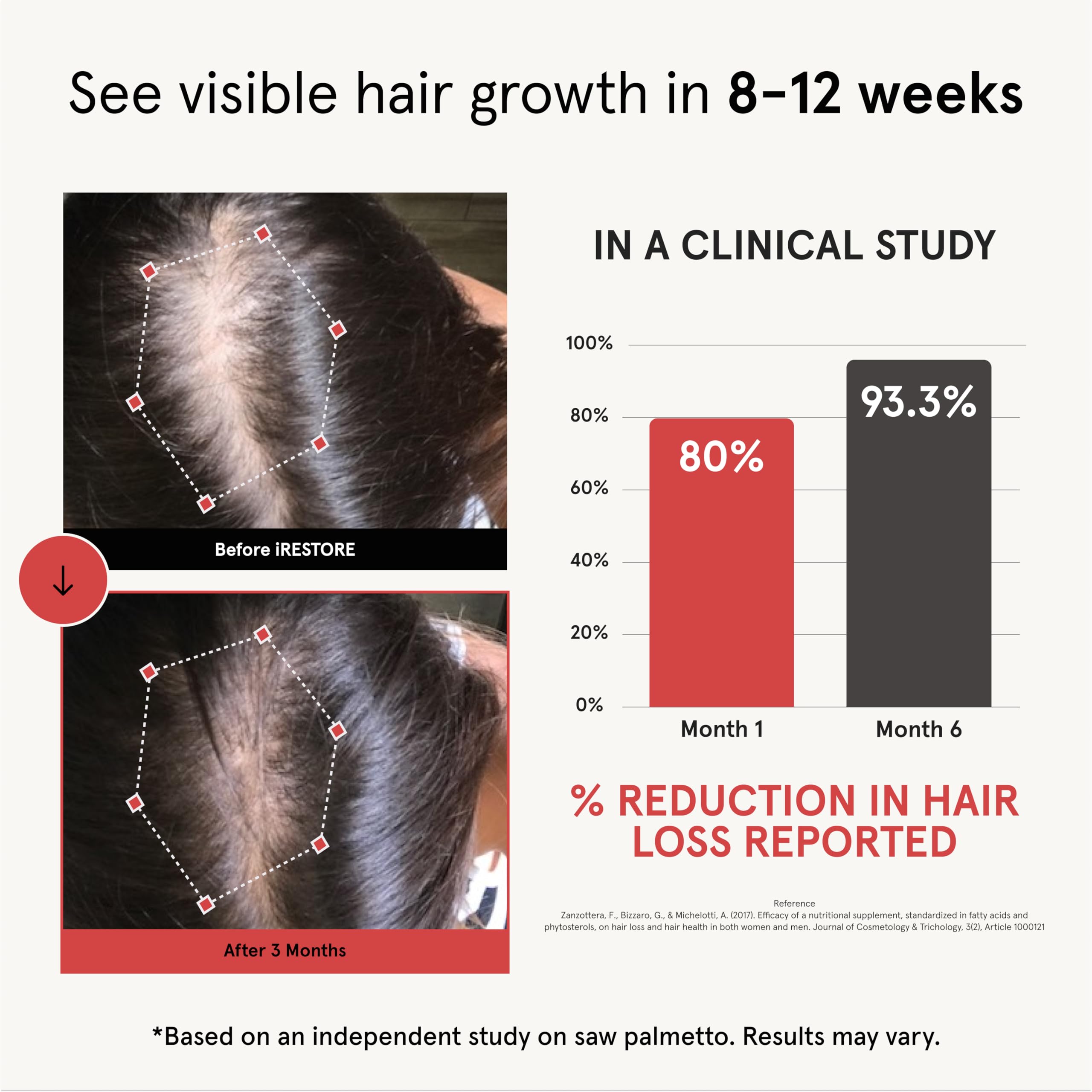 iRestore capsules close-up show vegan capsules supporting daily hair wellness.
