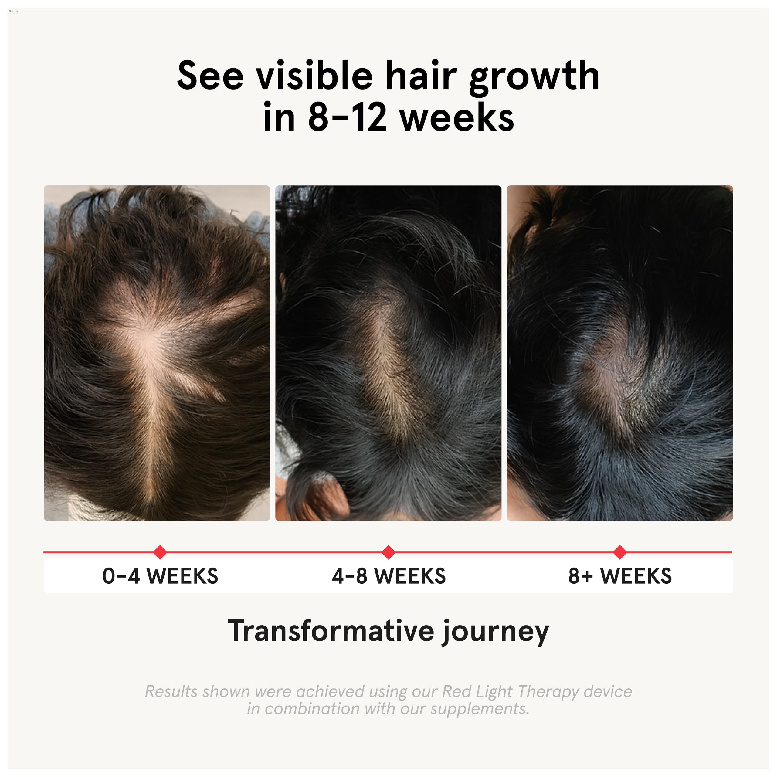 Close-up of iRestore capsules showing convenient daily use for hair wellness.