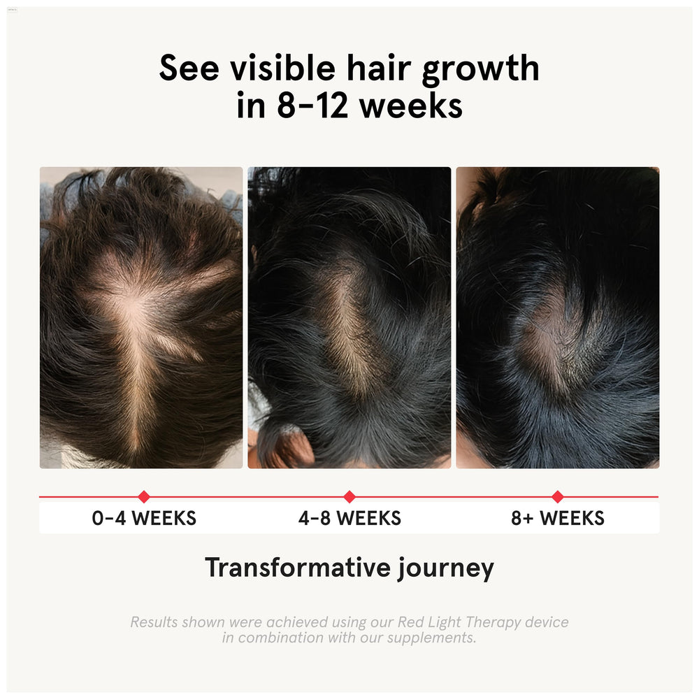 Close-up of iRestore capsules showing convenient daily use for hair wellness.