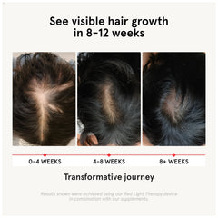 Close-up of iRestore capsules showing convenient daily use for hair wellness.
