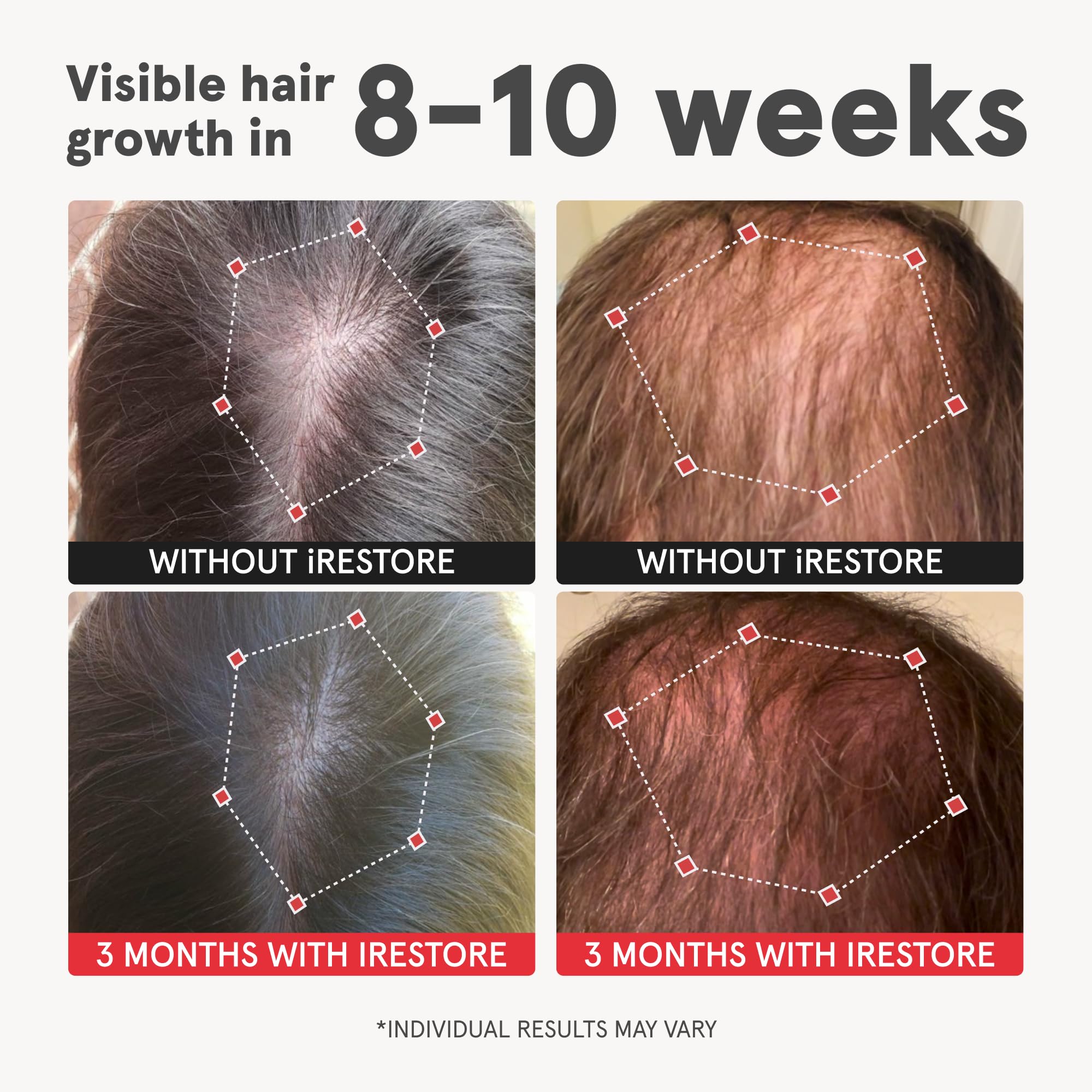 iRestore Lustriva capsules close-up for convenient daily dosing and vitality