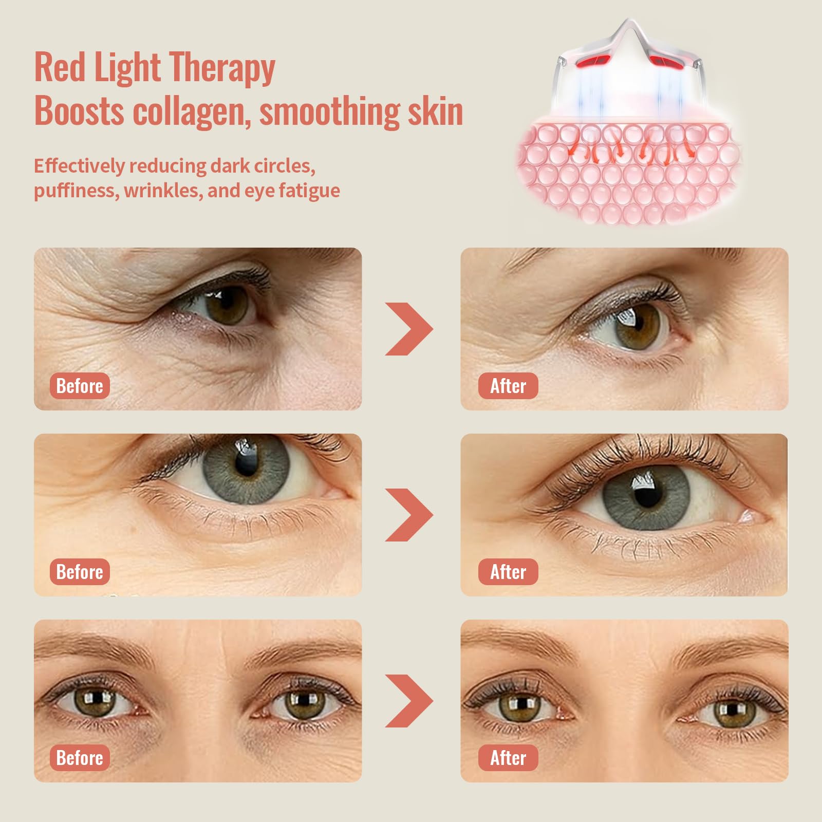 JCOTTON microcurrent eye massager demonstrates gentle contour care and reduced puffiness potential