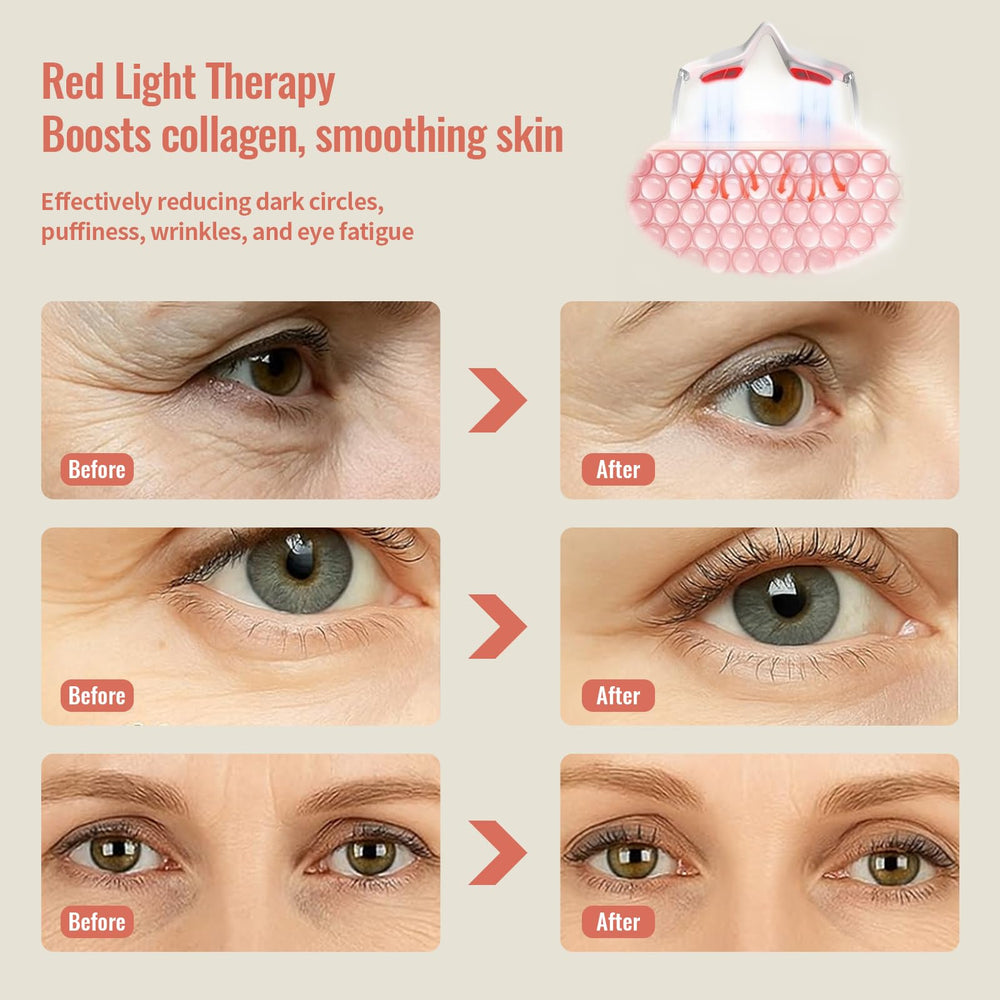 JCOTTON microcurrent eye massager demonstrates gentle contour care and reduced puffiness potential