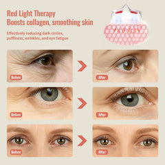 JCOTTON microcurrent eye massager demonstrates gentle contour care and reduced puffiness potential