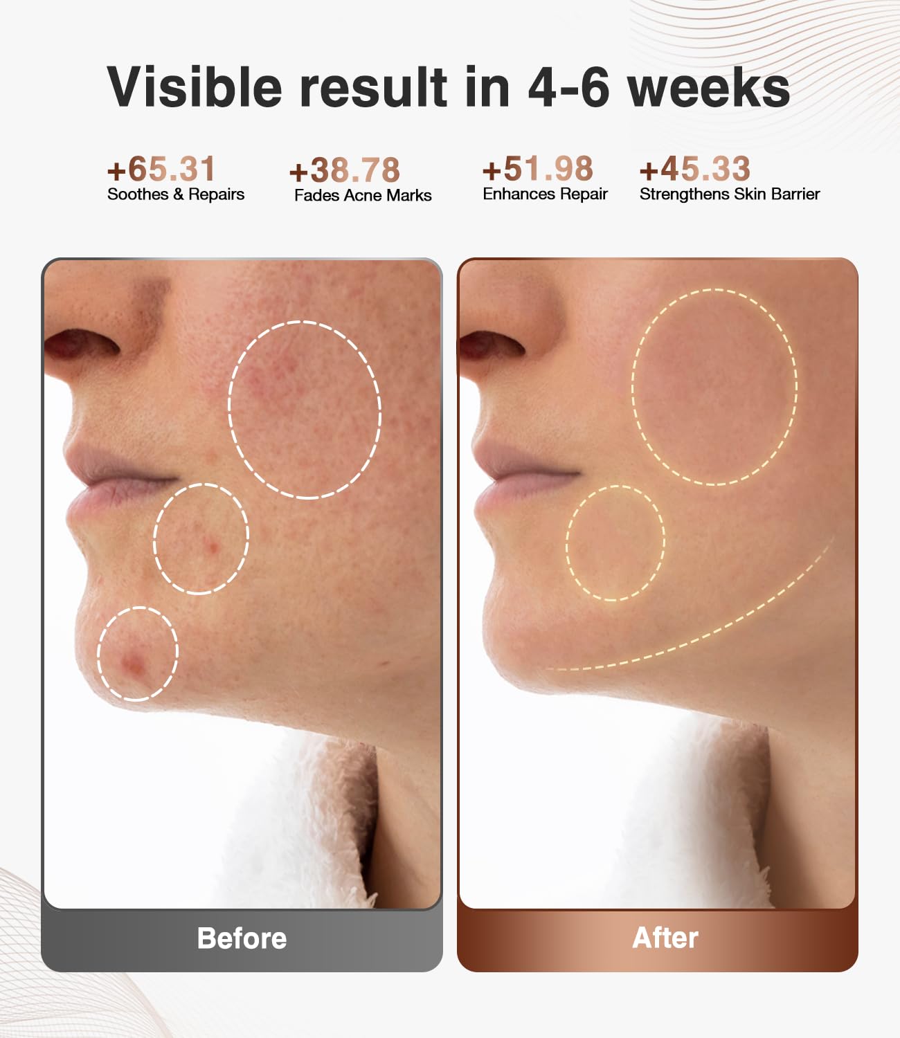 JOVS wireless design enables cordless treatments for a streamlined routine.