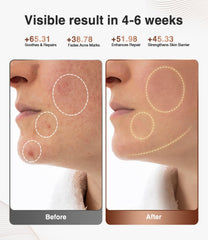 JOVS wireless design enables cordless treatments for a streamlined routine.