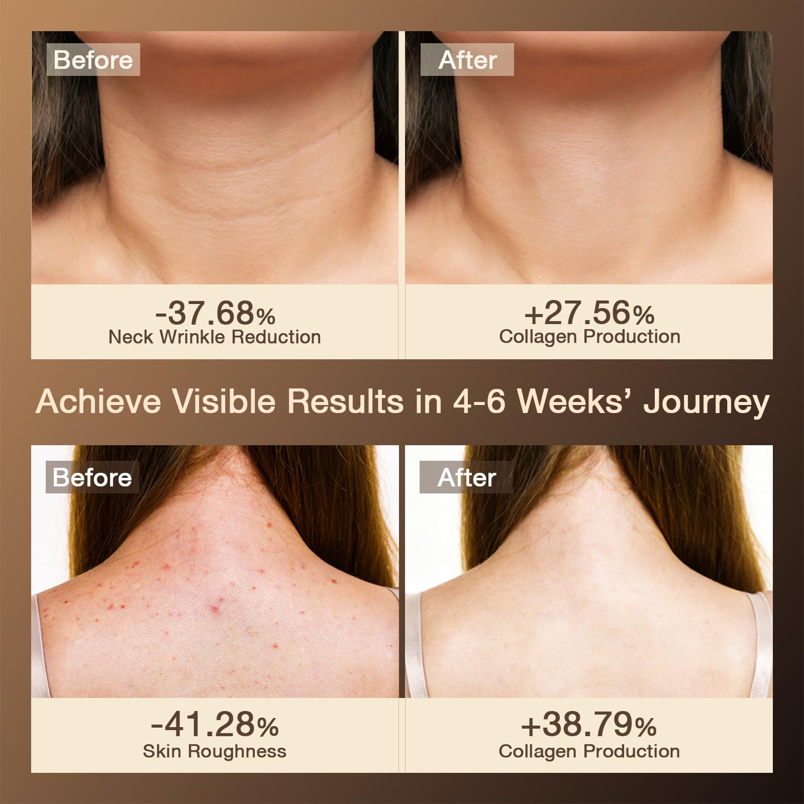 JOVS travel-friendly design shows wireless skincare on the go.