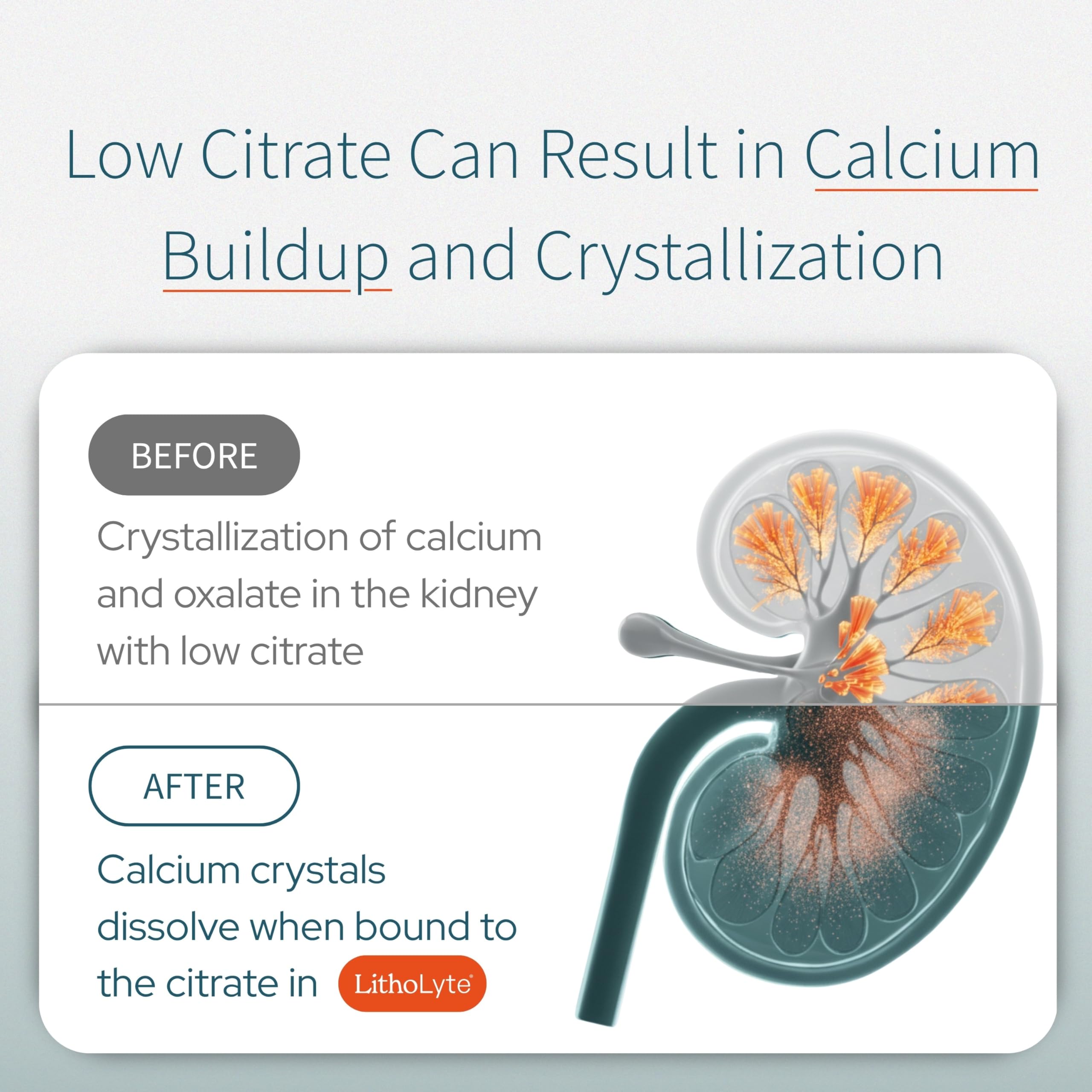 LithoLyte citrate content highlighted for daily urine chemistry support.