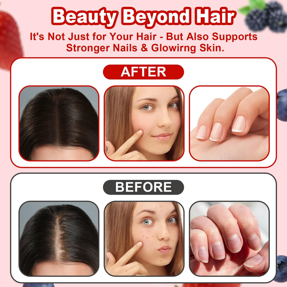 LUIMOLL Lumin Hair Growth Gummies mixed berry flavor displayed for a tasty daily ritual.