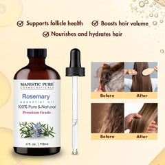 Majestic Pure Rosemary Oil dropper enabling precise application.
