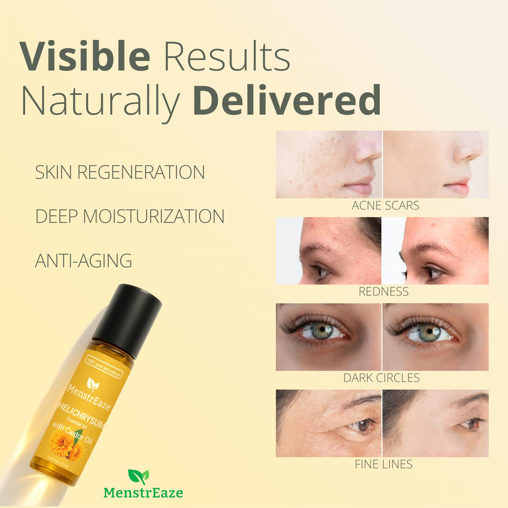MenstrEaze skin-nourishment glow on healthy-looking skin.