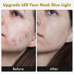 mhpoycd FM-03 LED mask side view worn for comfortable home phototherapy sessions.