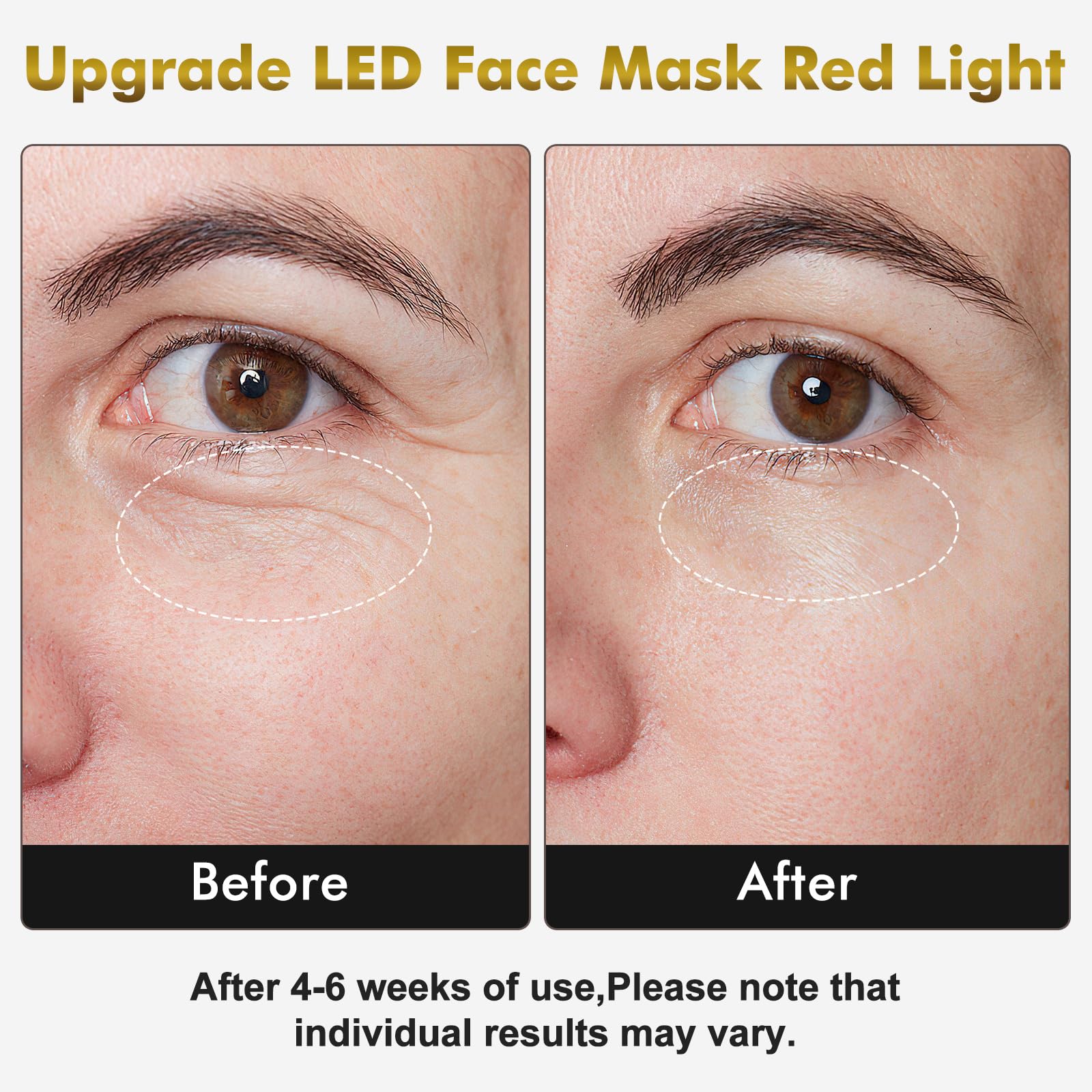 MHPoycd red light therapy face mask close-up shows silicone texture for comfortable sessions