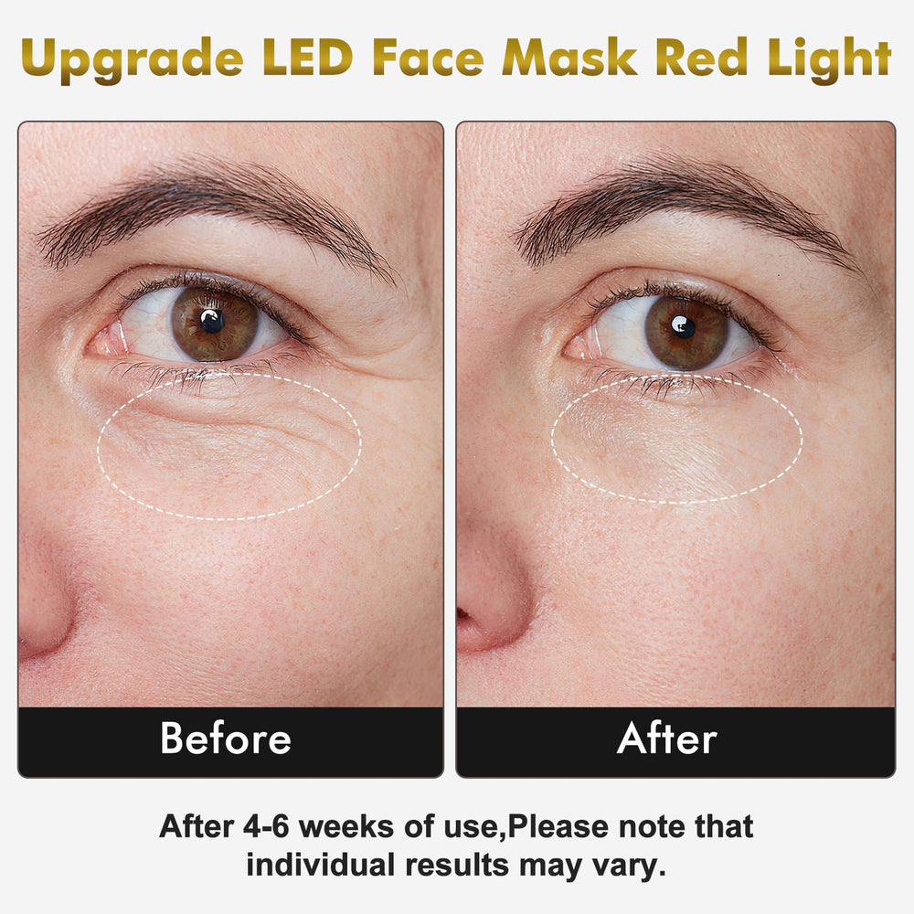 MHPoycd red light therapy face mask close-up shows silicone texture for comfortable sessions