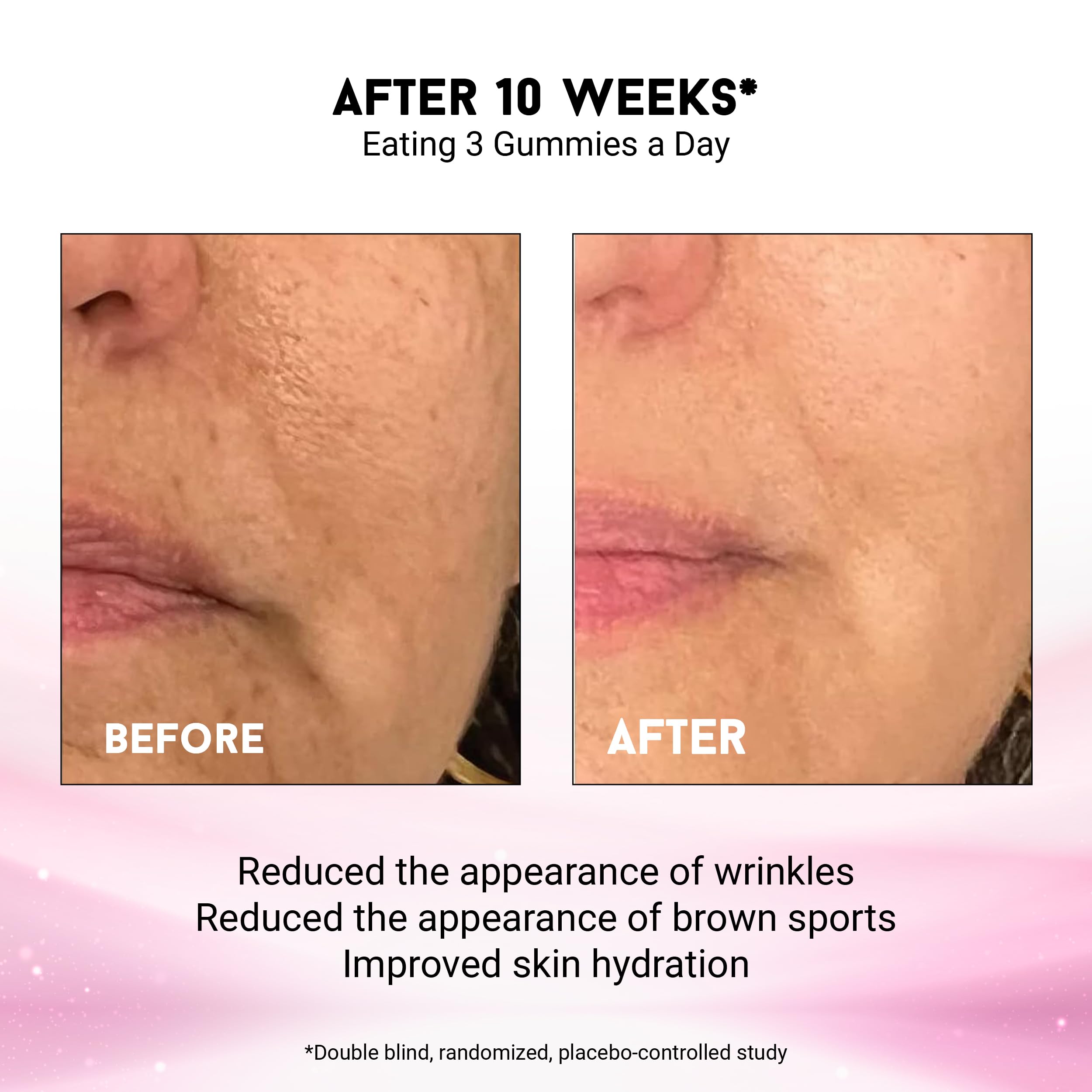 Miracle Elixir Collection even skin tone concept showing a balanced complexion.
