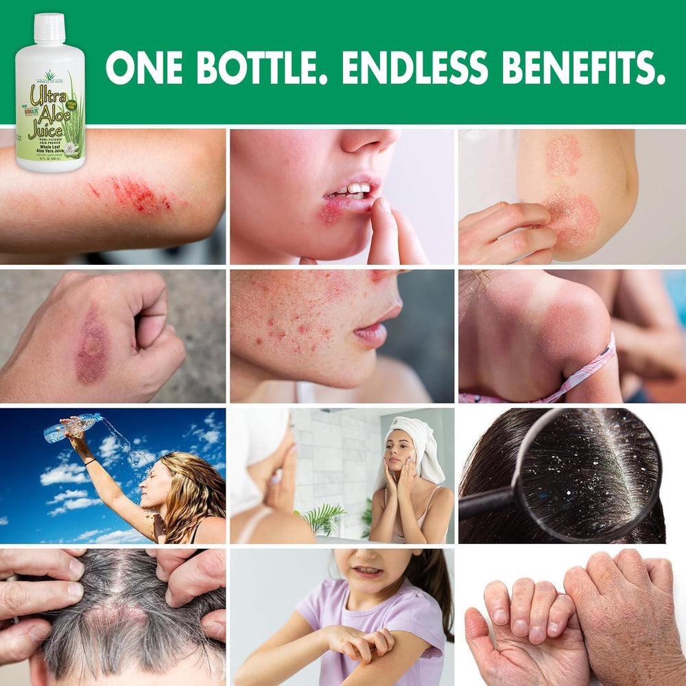 Miracle of Aloe Ultra Aloe juice bottle on counter; ready for daily use.