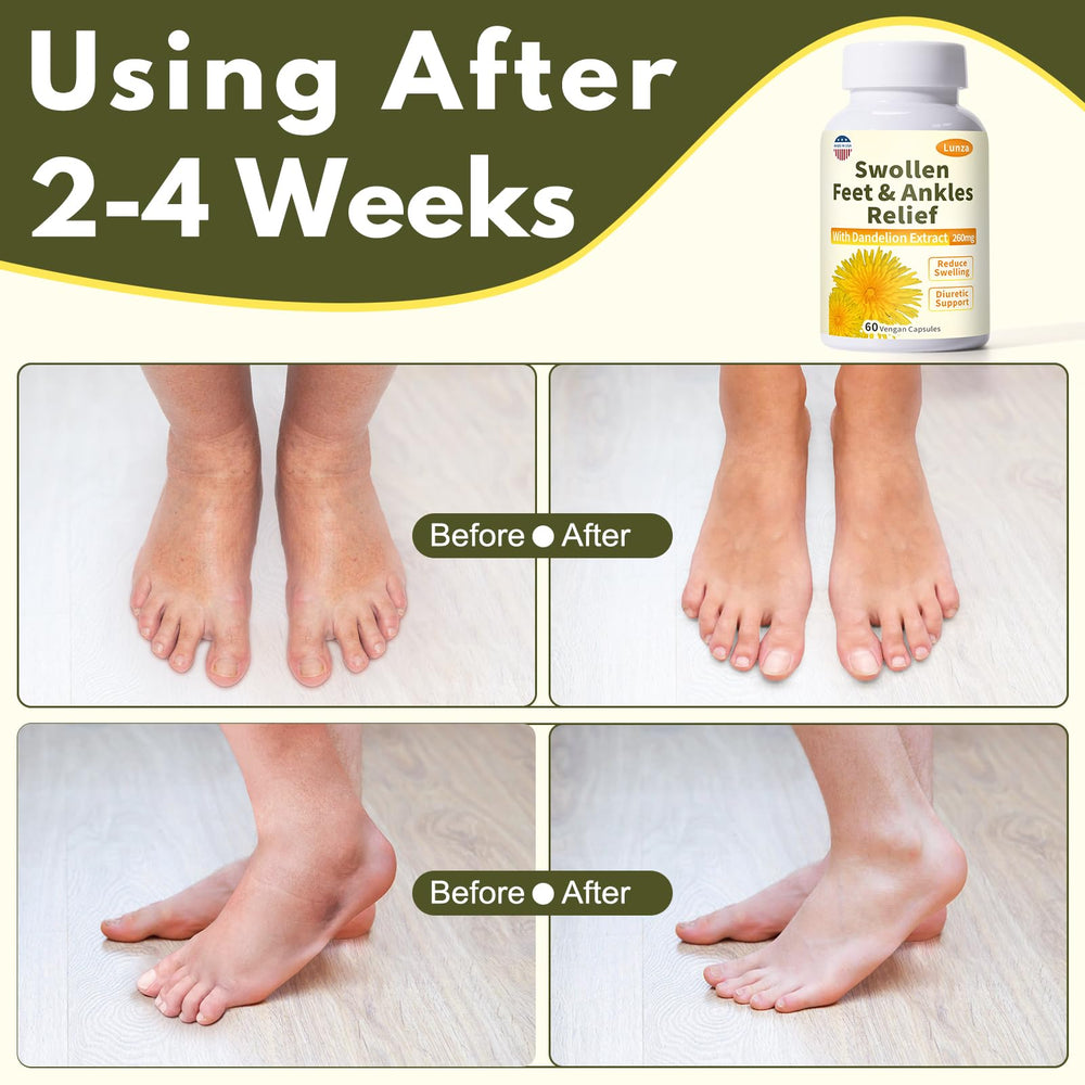 Netrca Swollen Feet bottle label highlights natural ingredients including dandelion.
