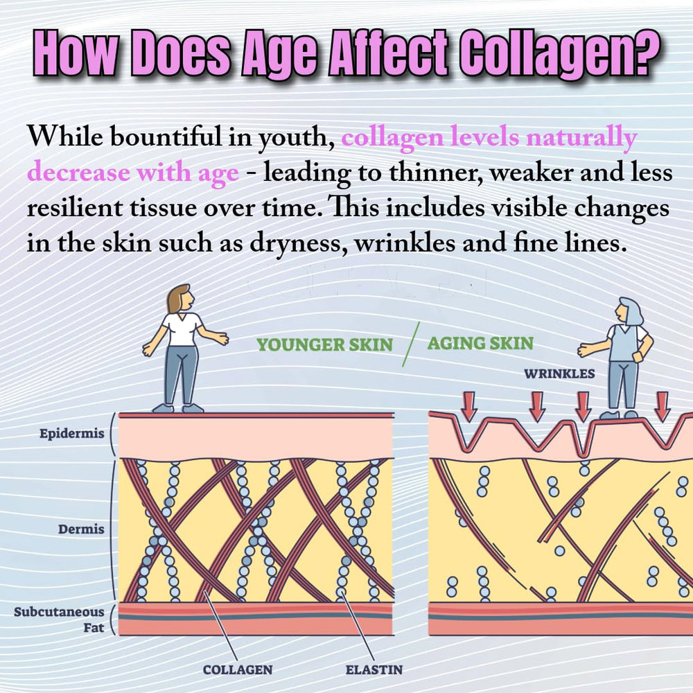 NeuVelleNutrition collagen pills anti-aging blend for youthful elasticity