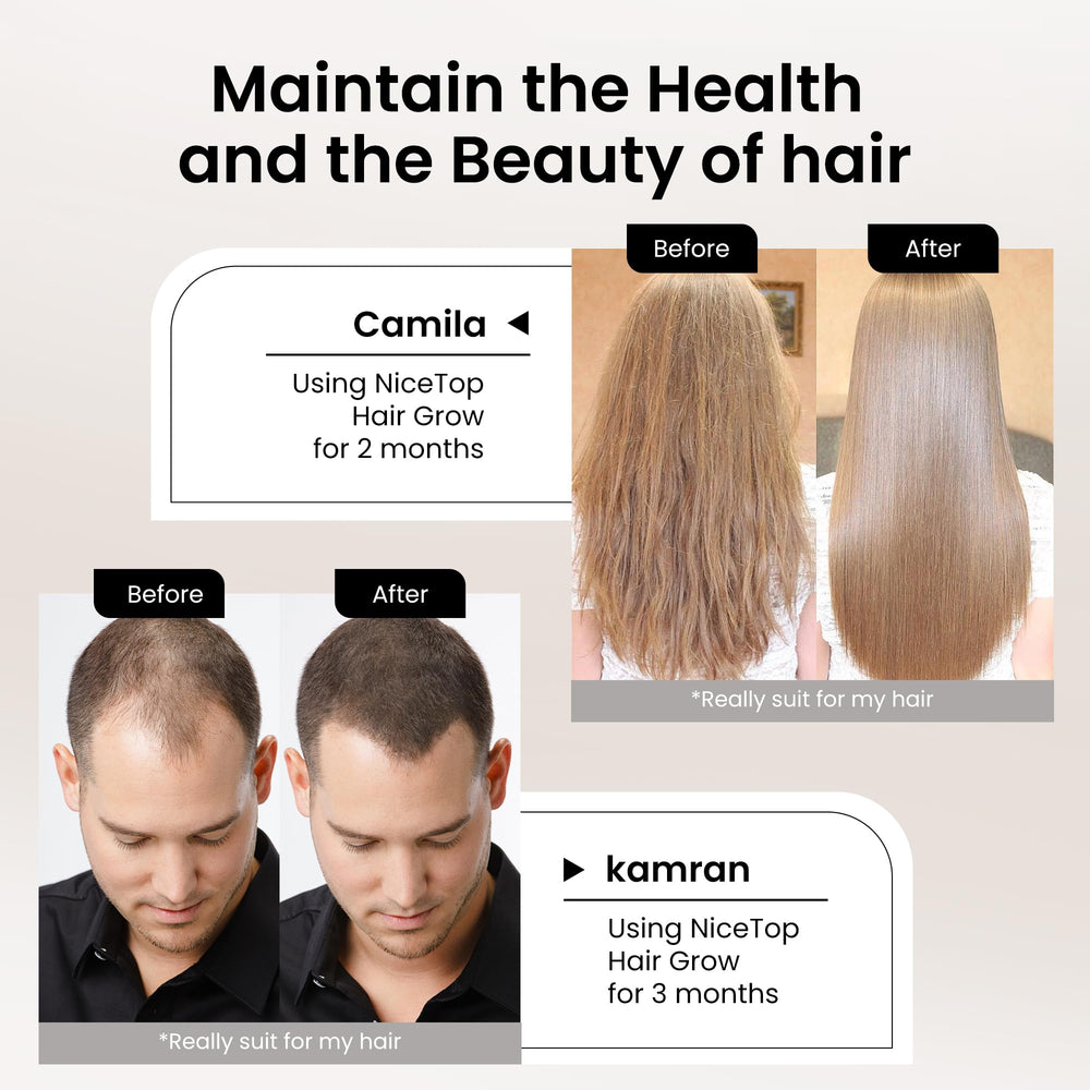 NiceTop Hair Growth ingredients label shows vitamins and minerals
