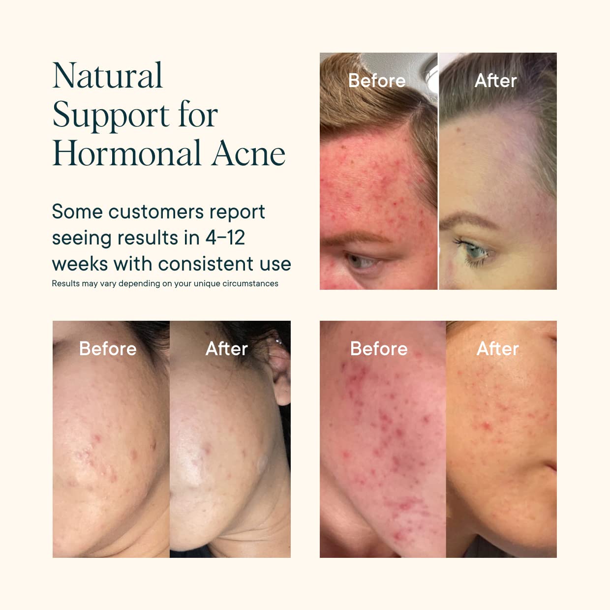 Ora Organic Hormone Balance burdock root display suggests cleansing wellness.