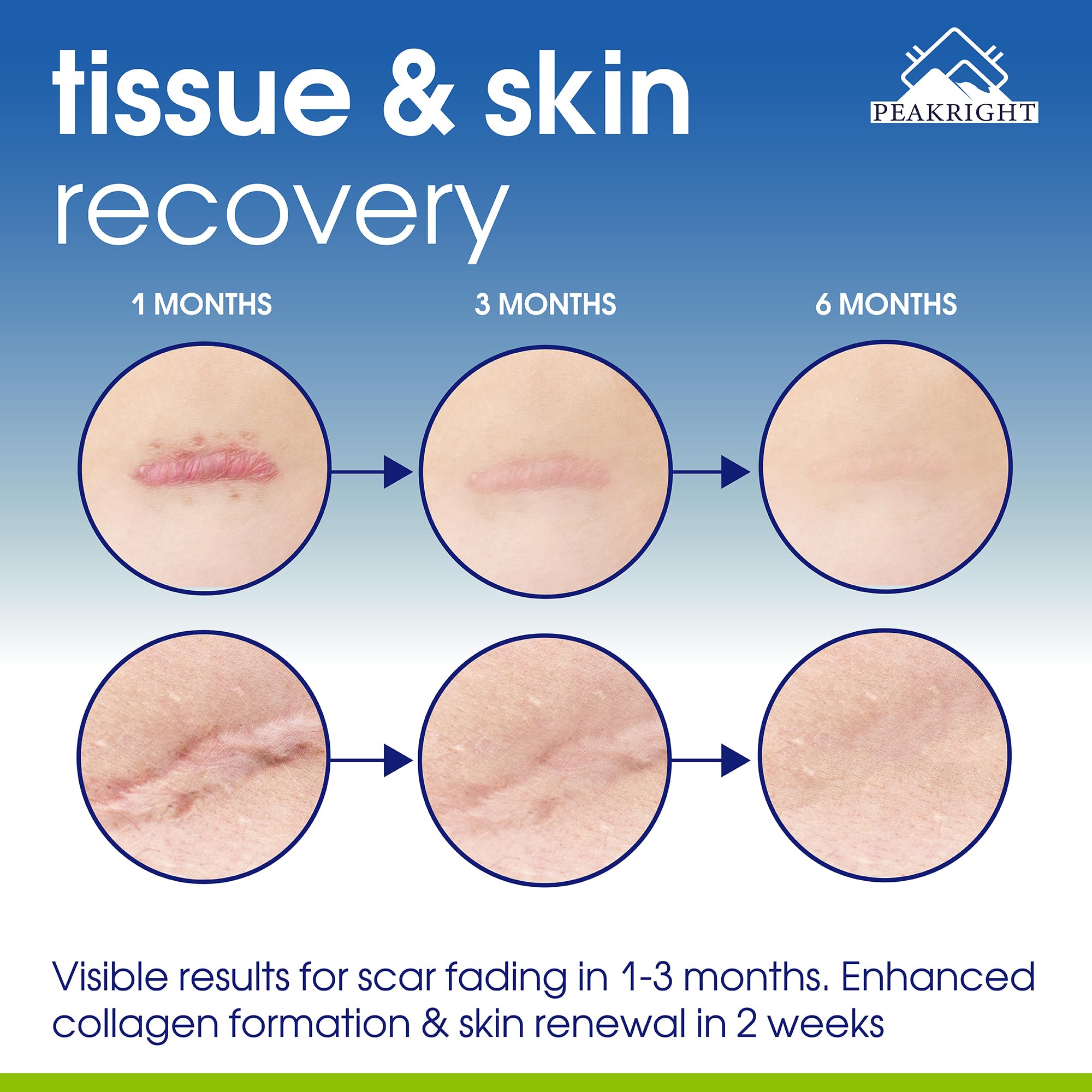 Peakright post-operative recovery scene with capsules and soft lighting.