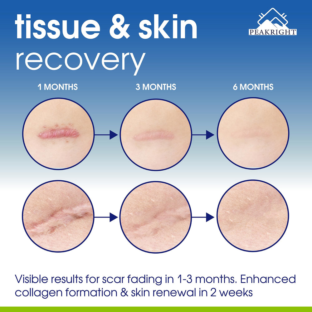 Peakright post-operative recovery scene with capsules and soft lighting.