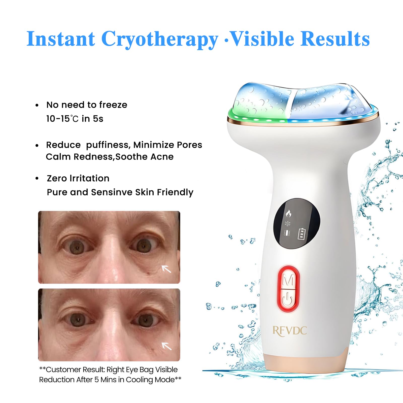 RFVDC LED therapy with multiple wavelengths boosts skin renewal.