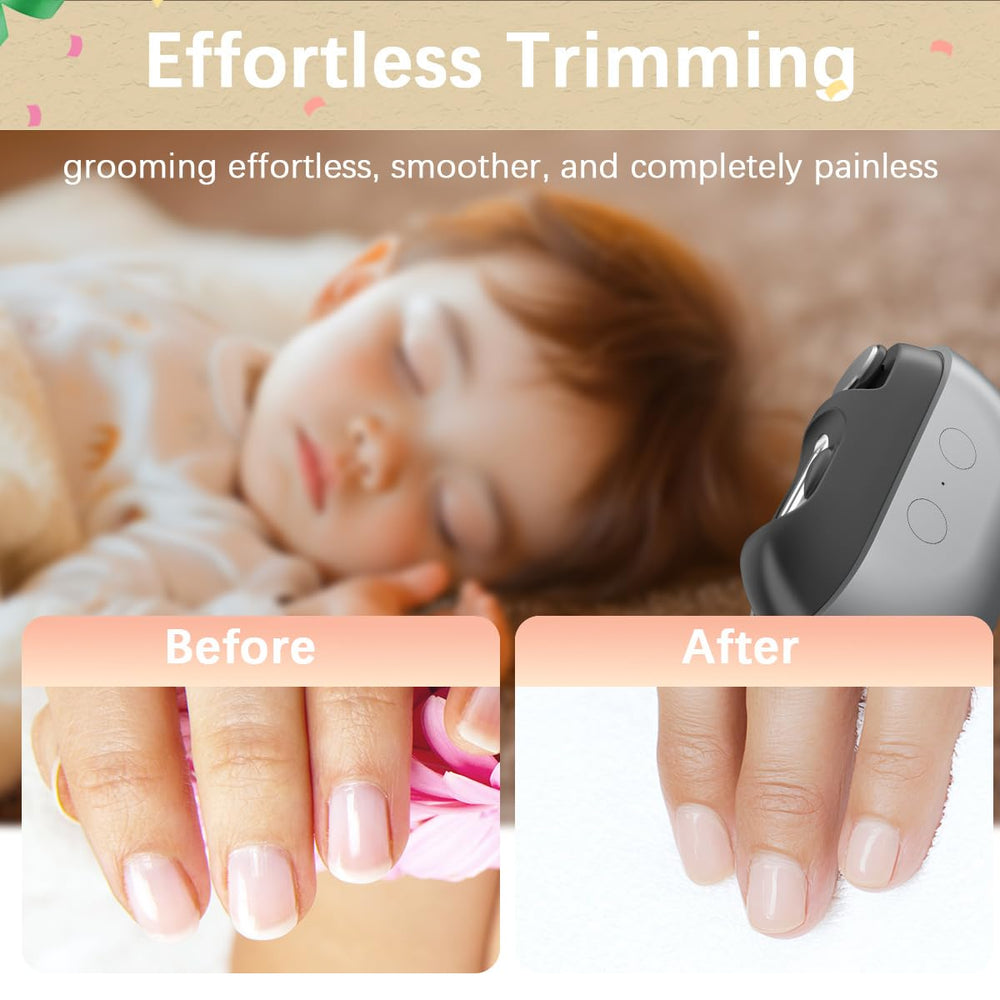 RIMOL LED light activation shows nails clearly for precise trimming.