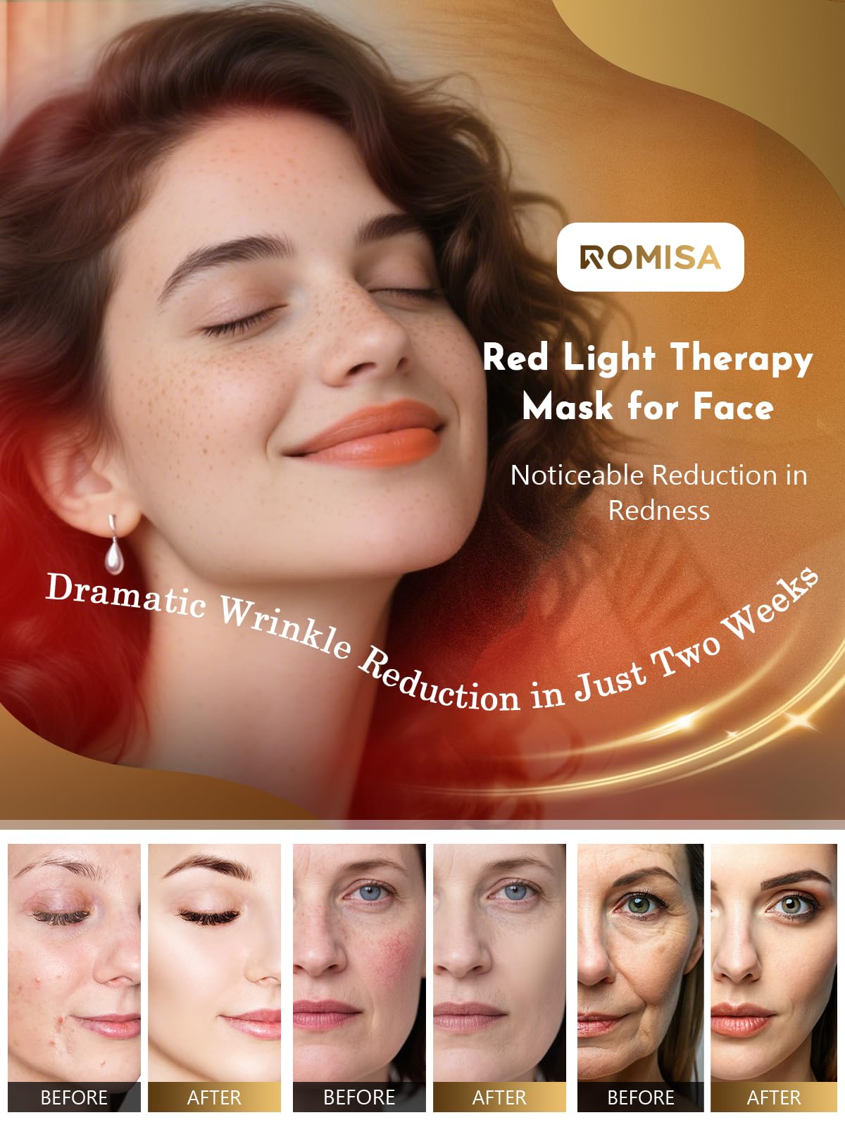 ROMISA eye protection shield blocks glare during treatment
