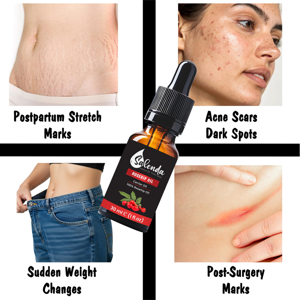 Salenda Rosehip Oil packaging image emphasizes clean, simple 1 oz bottle