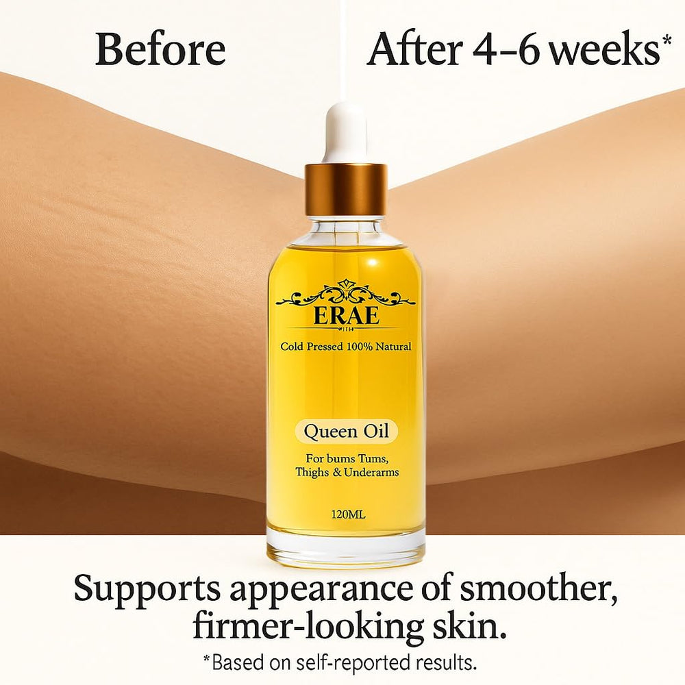 SDXJIOGE Erae Queen Oil on tummy for hydration and subtle firming.